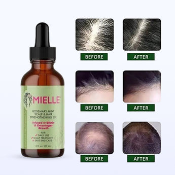 NurturaScalp™ Organic Rosemary Oil